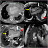 FIGURE 27