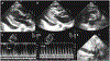 FIGURE 20