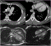 FIGURE 32
