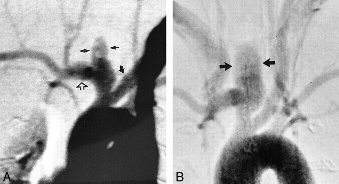 fig 6.