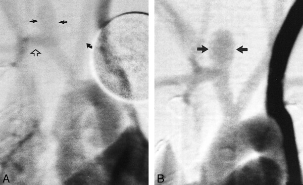 fig 4.