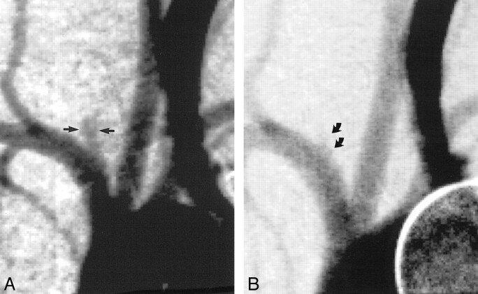 fig 3.