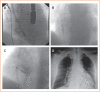 Figure 4: