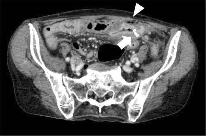 Fig. 1