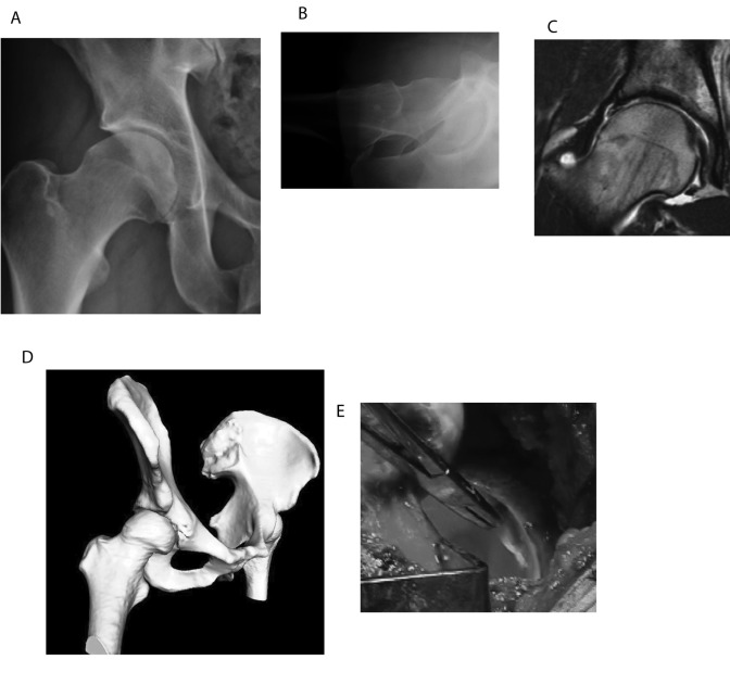 Fig. 17