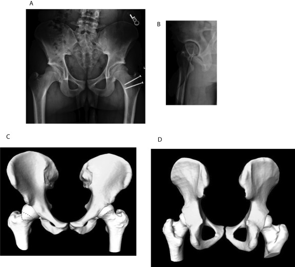 Fig. 14