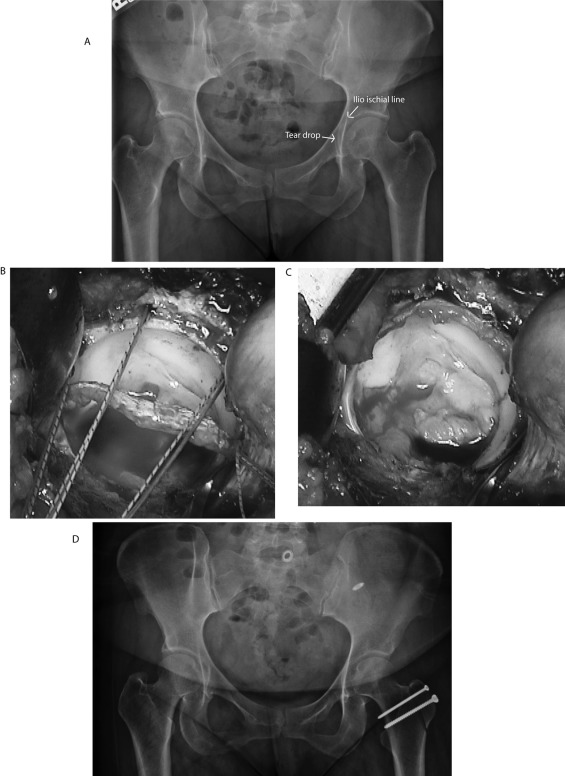 Fig. 5