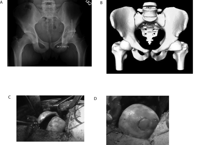 Fig. 15