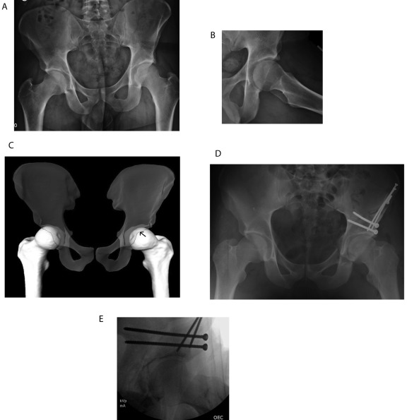 Fig. 18