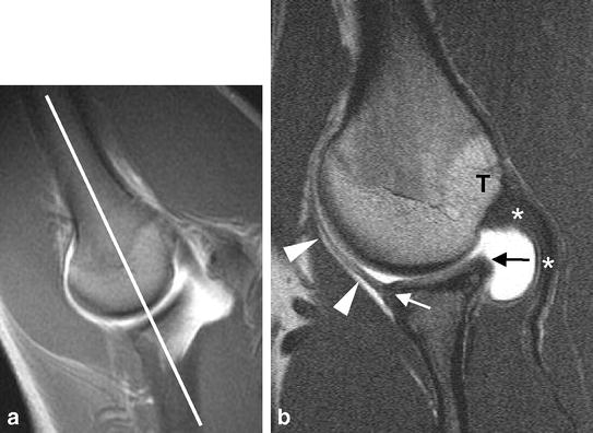 Fig. 1a, b