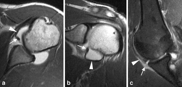 Fig. 3a–c