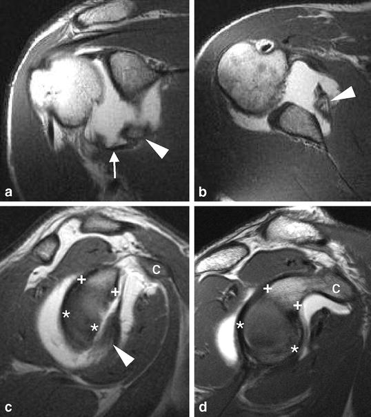 Fig. 4a–d