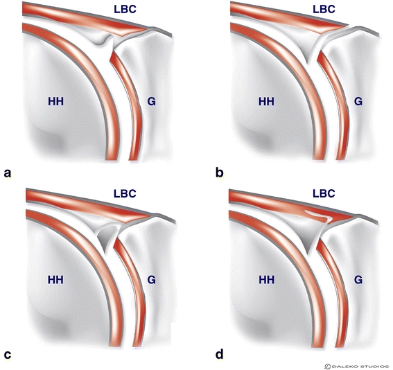 Fig. 13a–d