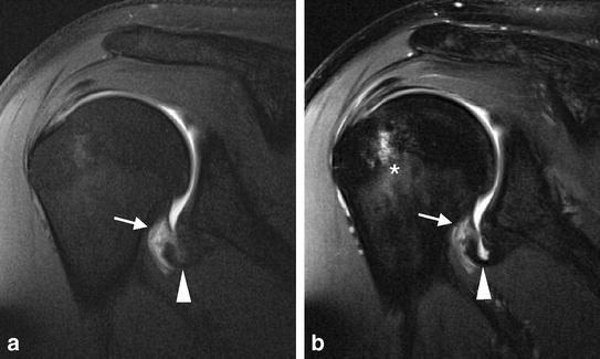 Fig. 8a, b