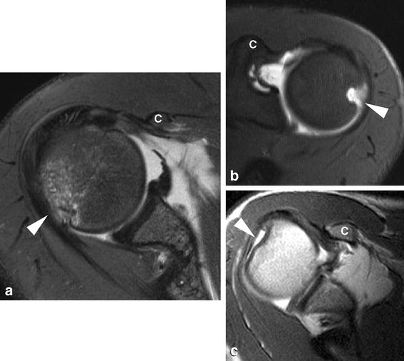 Fig. 10a–c