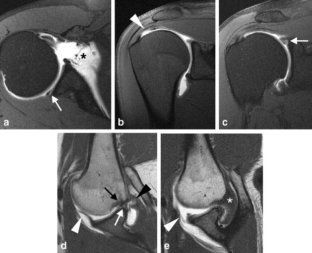 Fig. 12a–e