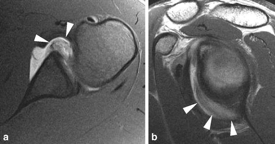 Fig. 11a, b