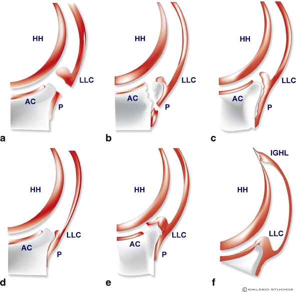 Fig. 2a–f