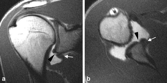 Fig. 6a, b