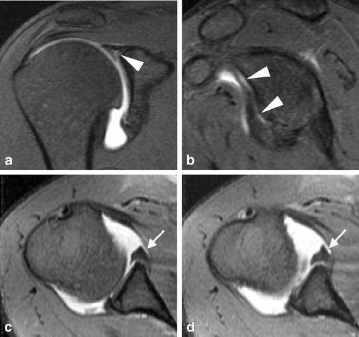 Fig. 15a–d