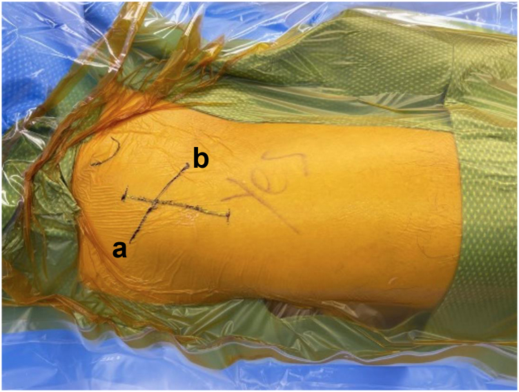 Figure 1