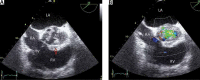 FIGURE 14