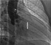 FIGURE 16