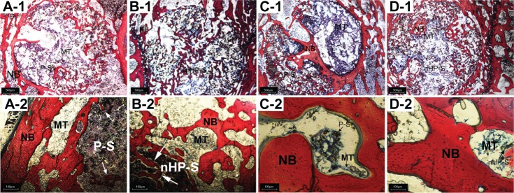 Figure 14