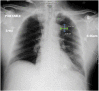 Fig. 1
