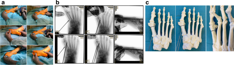 Fig. 4