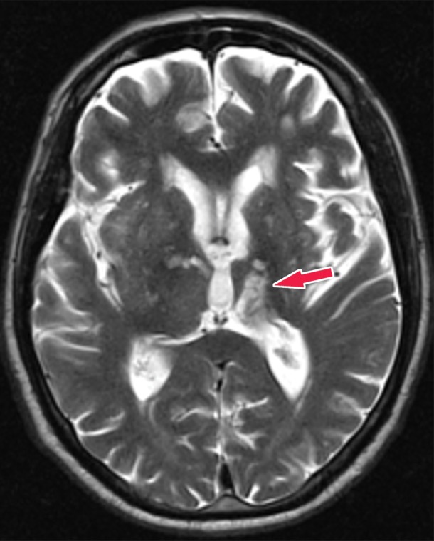 Figure 21b.