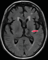 Figure 21a.