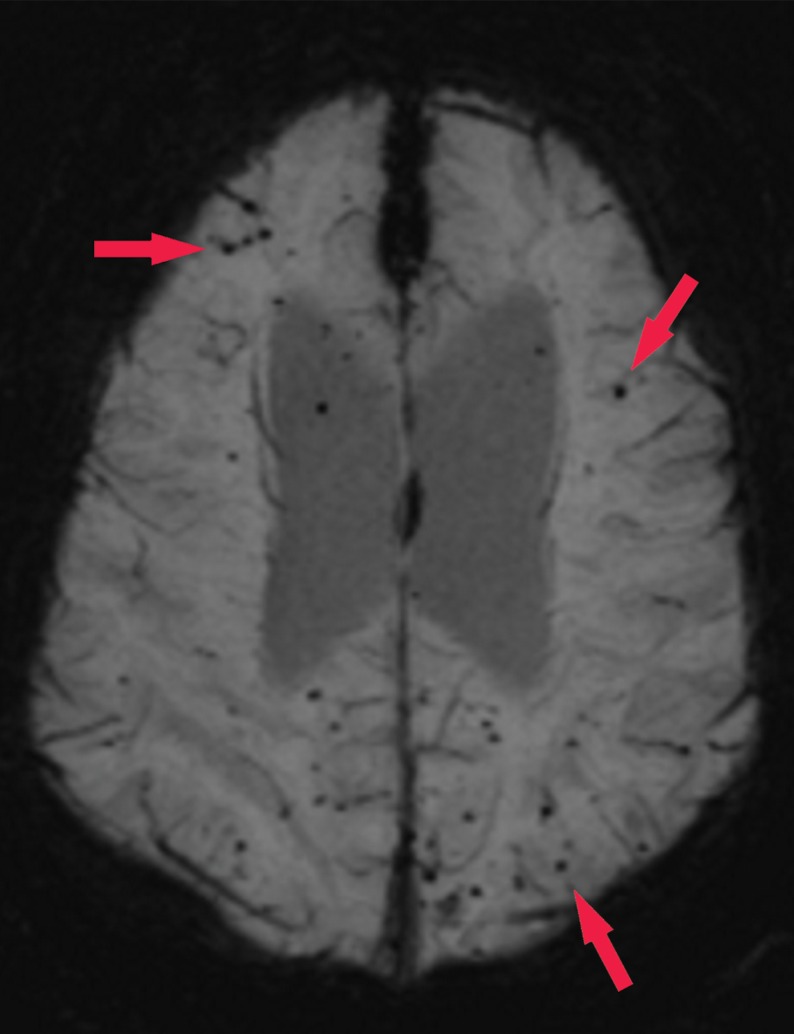 Figure 16e.