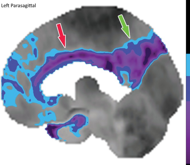 Figure 10b.