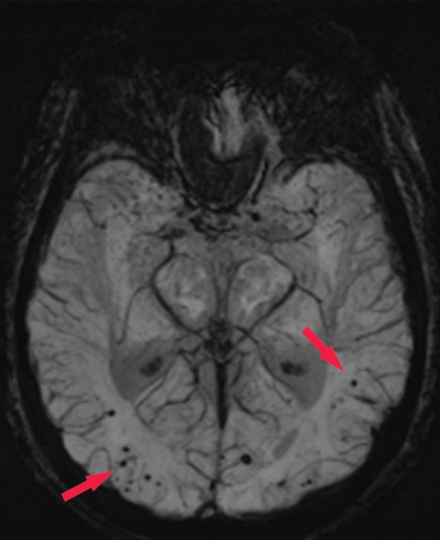 Figure 16d.