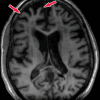 Figure 20a.