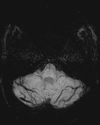 Figure 16f.