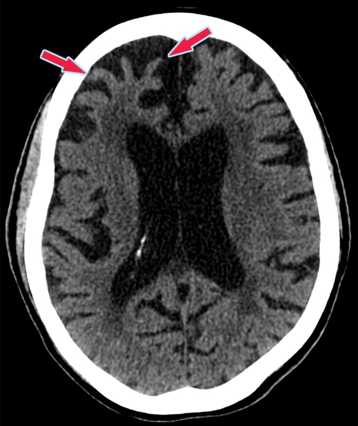 Figure 20c.