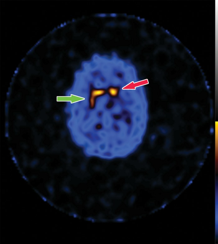 Figure 18a.