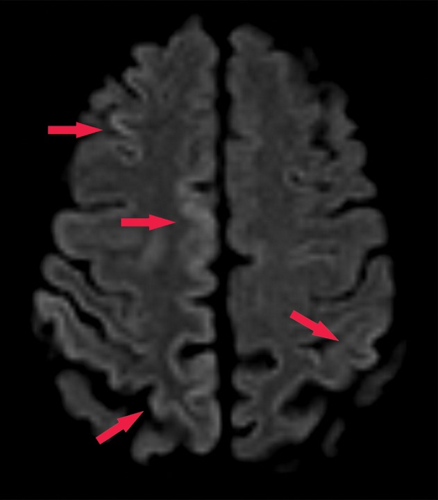 Figure 24b.