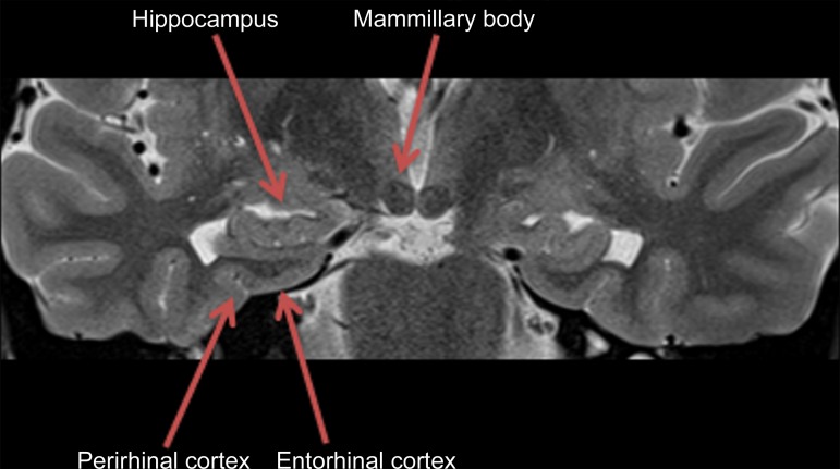 Figure 2b.