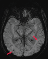 Figure 16d.