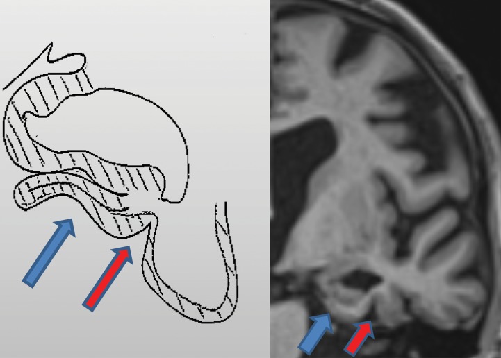 Figure 3b.