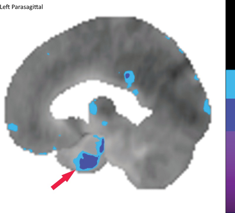 Figure 10a.