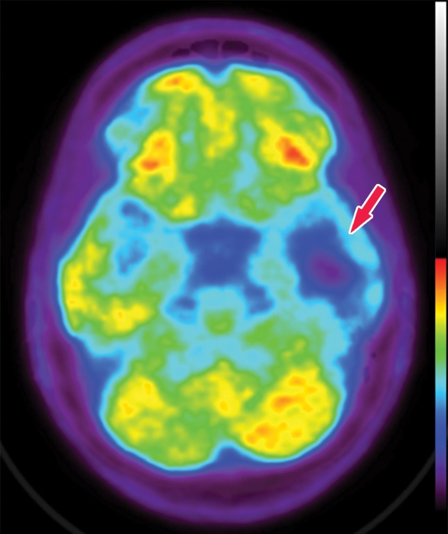 Figure 1c.