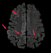 Figure 24a.