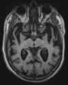 Figure 19c.