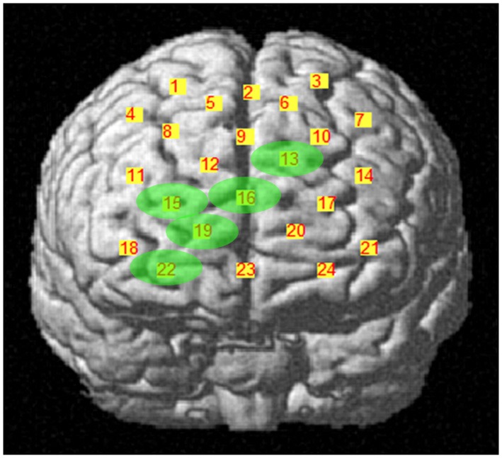 Figure 3