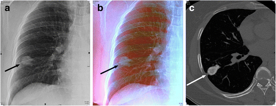 Fig 1