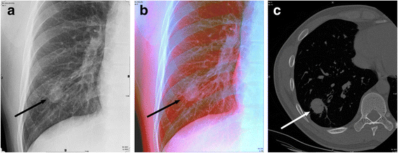Fig 2